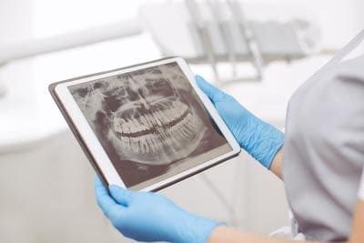 Dr. Tang's assistant reviewing a patient's dental x-rays prepping for a routine dental cleaning.